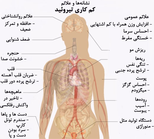 کم کاری تیروئید