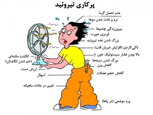 پرکاری تیروئید